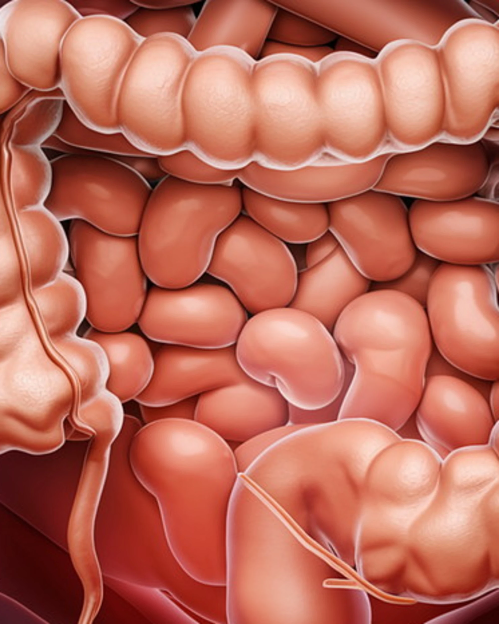 Tumore al colon-retto, i segnali da non sottovalutare