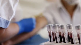 Coronavirus, il bollettino del Lazio: "184 positivi, calano i contagi di rientro dalla Sardegna"