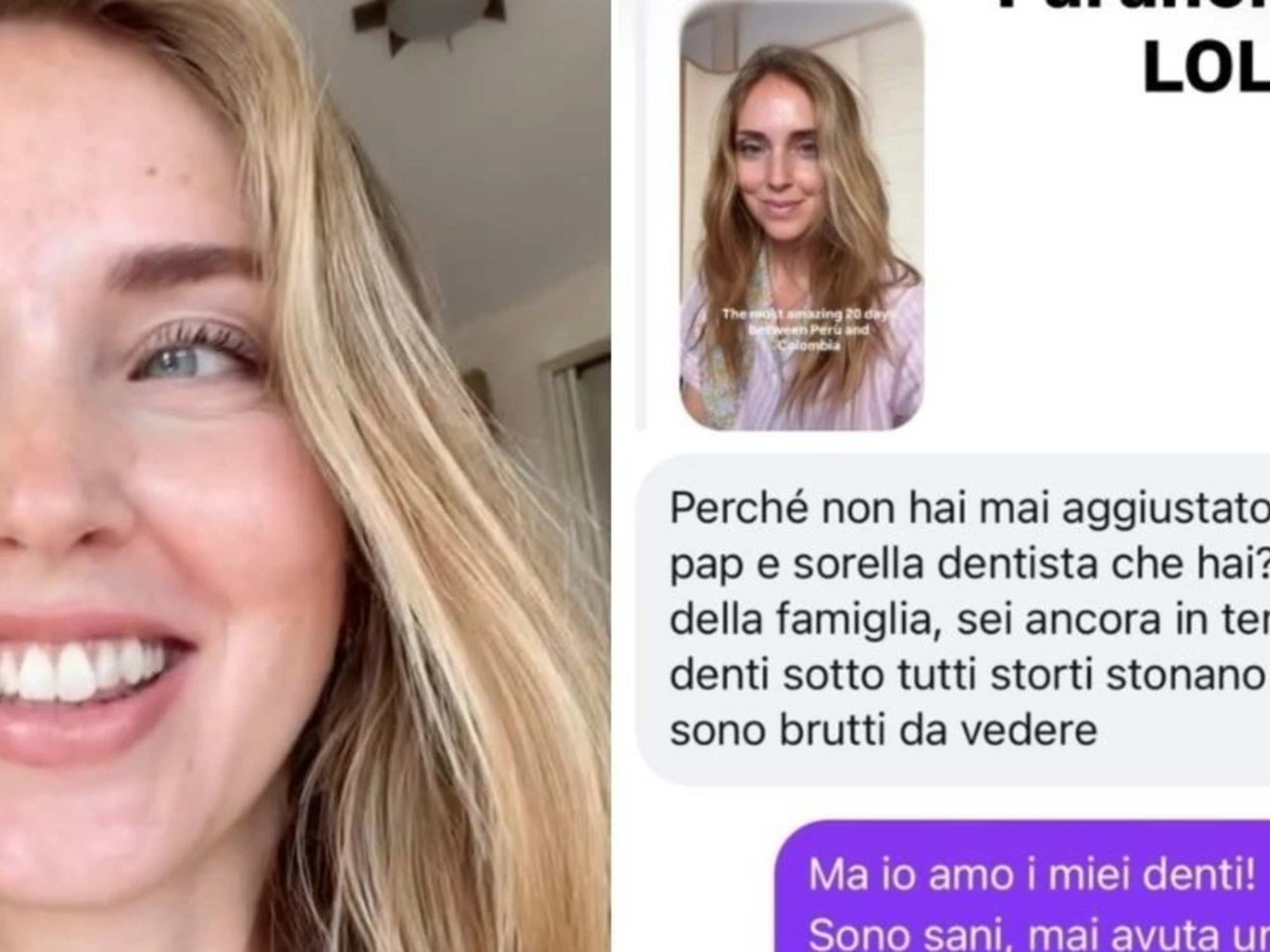 Chiara Ferragni, "hai i denti tutti storti e sono brutti da vedere": la risposta gela tutti