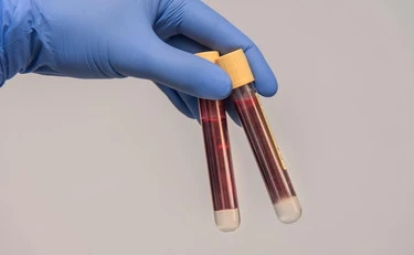 La bimba ha l'Hiv? La scelta choc dei genitori: scoppia il caso