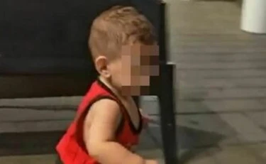 Bimbo col cuore bruciato, "emorragia cerebrale in corso": il quadro si fa disperato