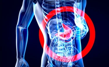 Reflusso gastrico, attenzione ai farmaci: cosa evitare