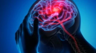 Australia, donna soffriva di depressione: nel cervello un verme vivo