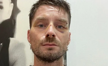 Novella 2000, "fame di sangue": il direttore brutalmente pestato a Milano