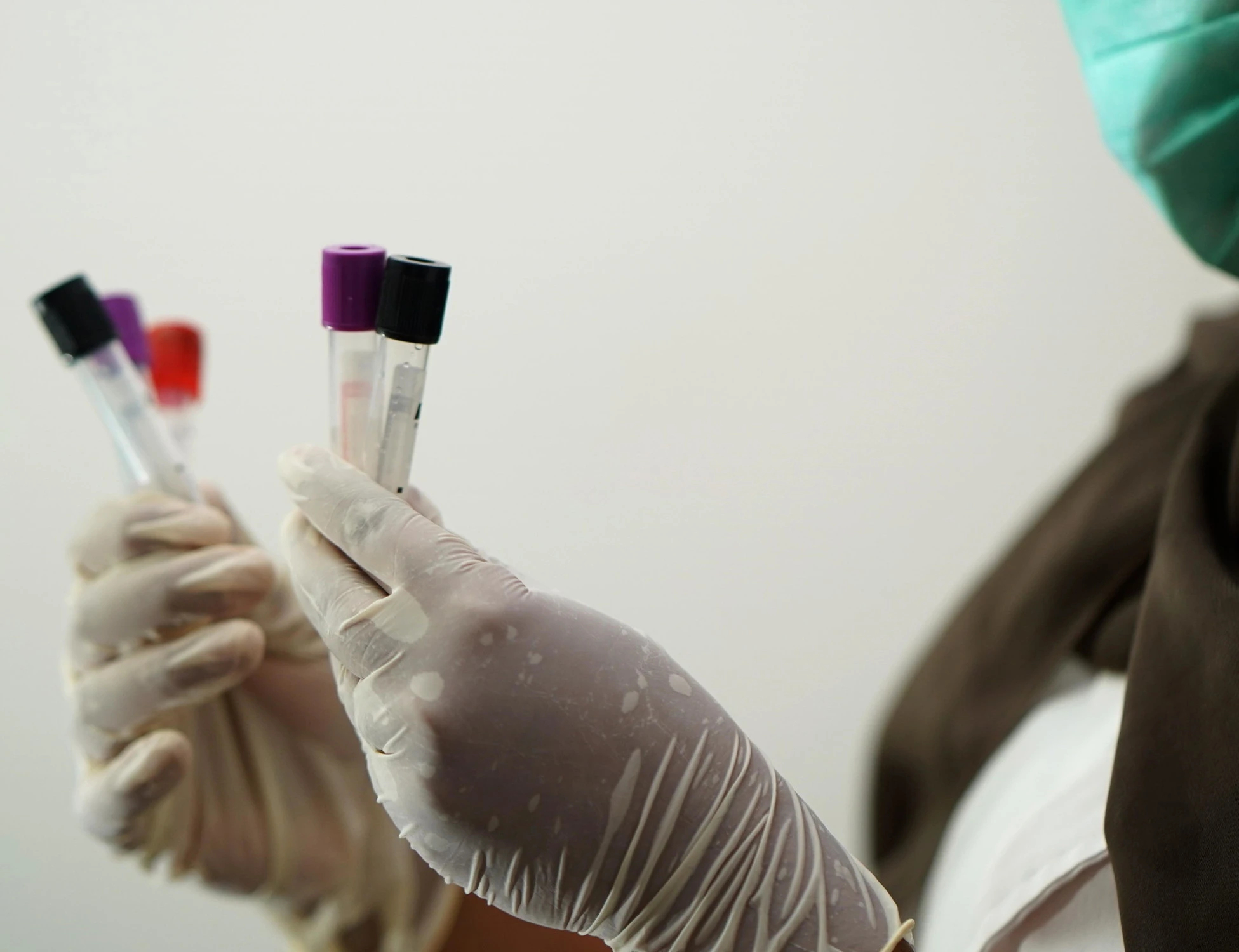 Pietracatella, "summit al centro Antiveleni": il cerchio si chiude?