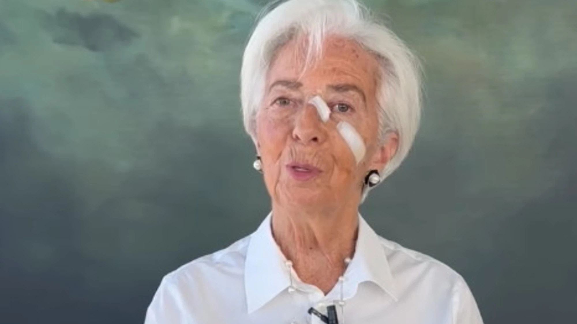 Lagarde sfregiata: cerotti in faccia, cosa le è successo
