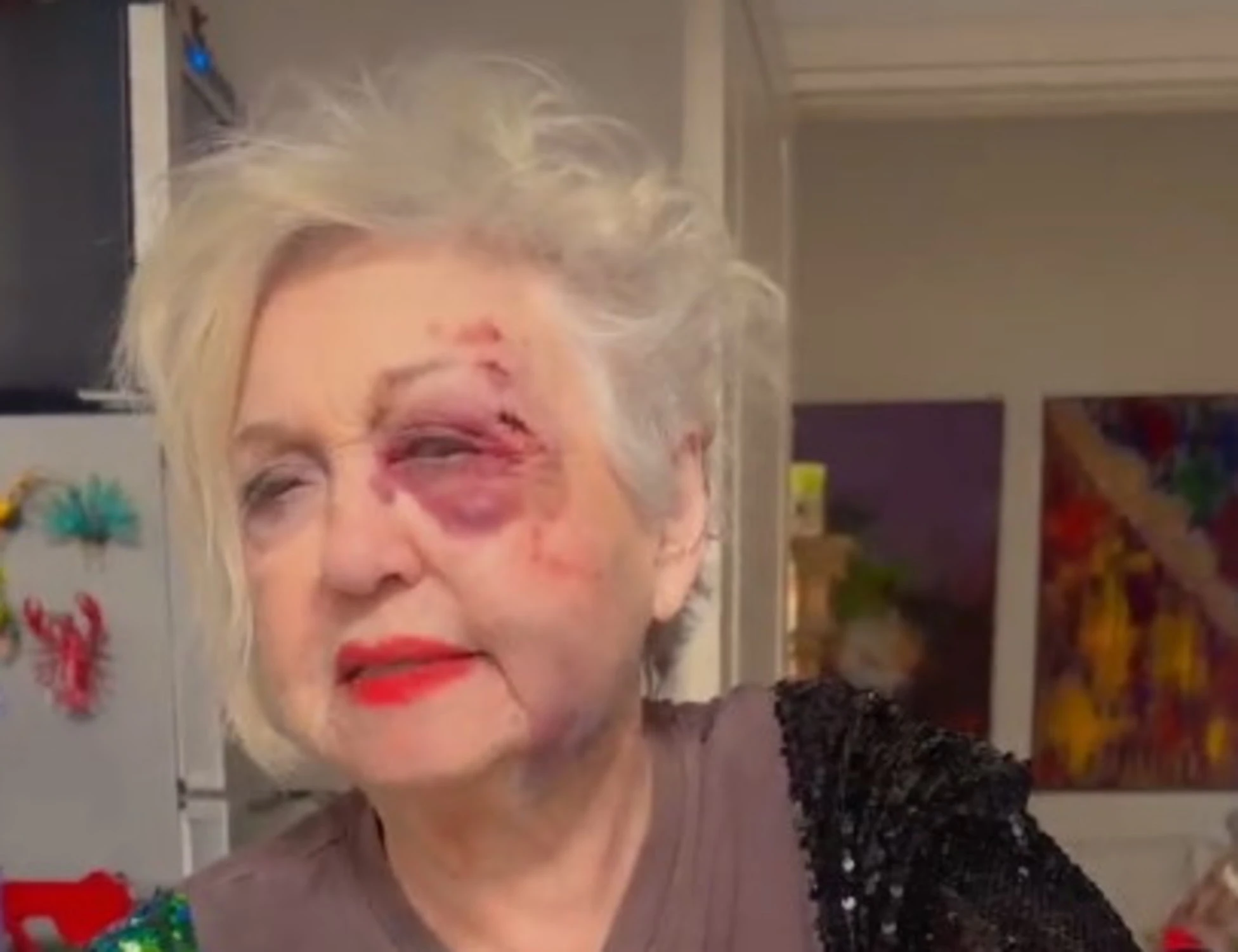 Wanna Marchi investita a Milano, "non ricordo nulla": com'è ridotta