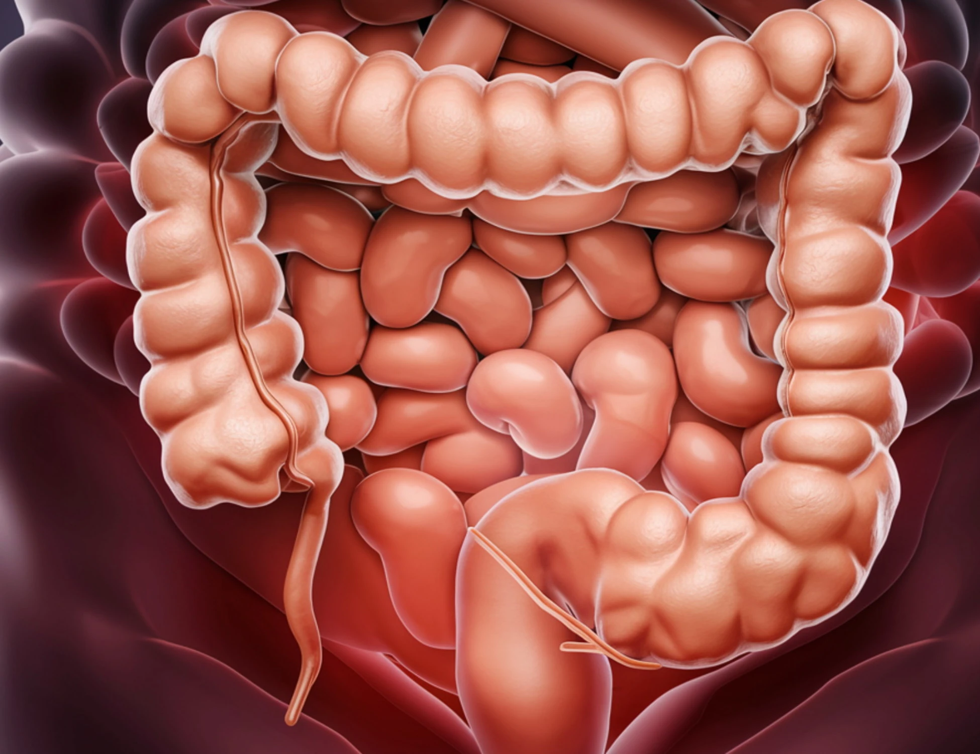 Colon irritabile, allarme rosso per il cambio di stagione: cosa può accadere