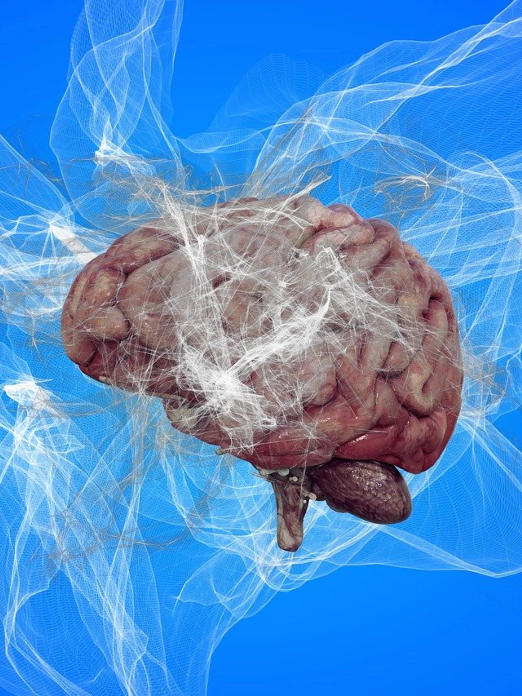Alzheimer e fase-Rem: ecco chi è a rischio