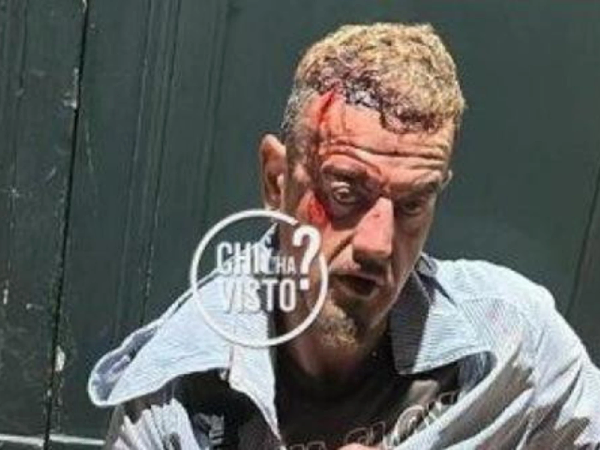 &quot;Animale, come l'ha ammazzata&quot;: Kaufmann da film dell'orrore