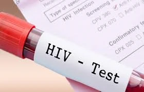 Il Garante: "Test hiv su minori anche senza consenso genitori"