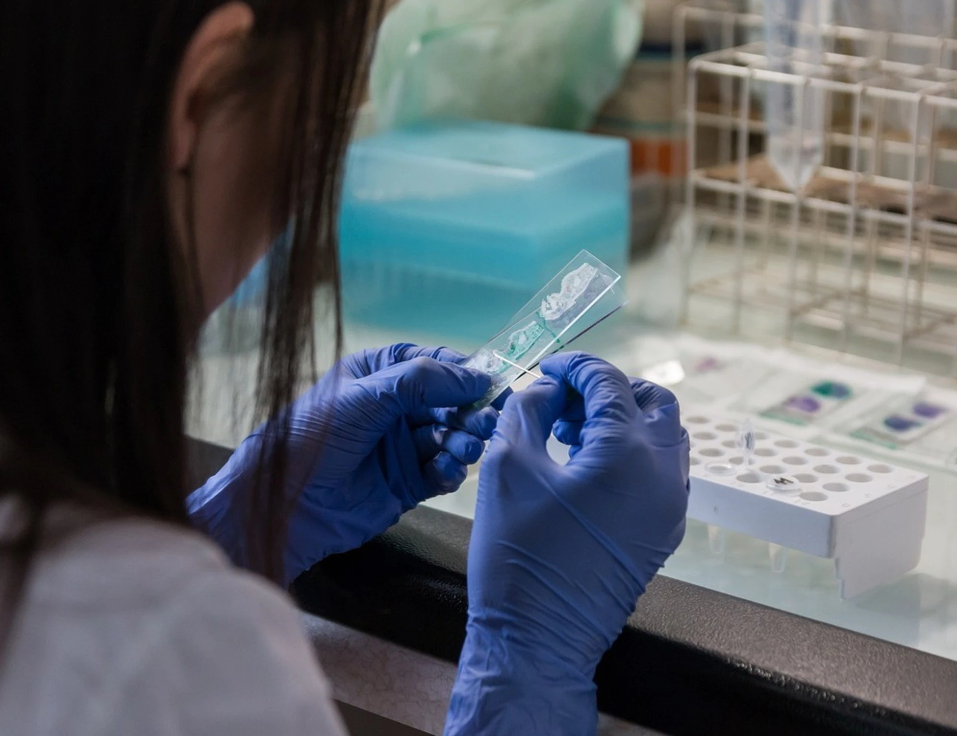 Regno Unito, focolaio di meningite: due morti, 11 casi gravi