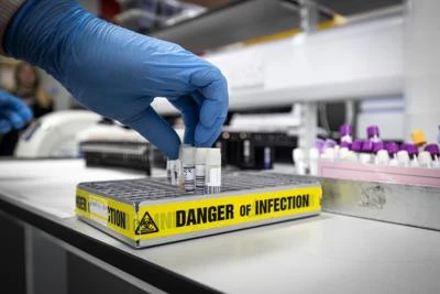 Coronavirus, virologo: "Dovremo abituarci a conviverci"