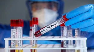 Bollettino 21 marzo: 32mila casi e 119 morti, ma salgono i ricoveri. "Aumento su base settimanale del 13%",  le tendenze