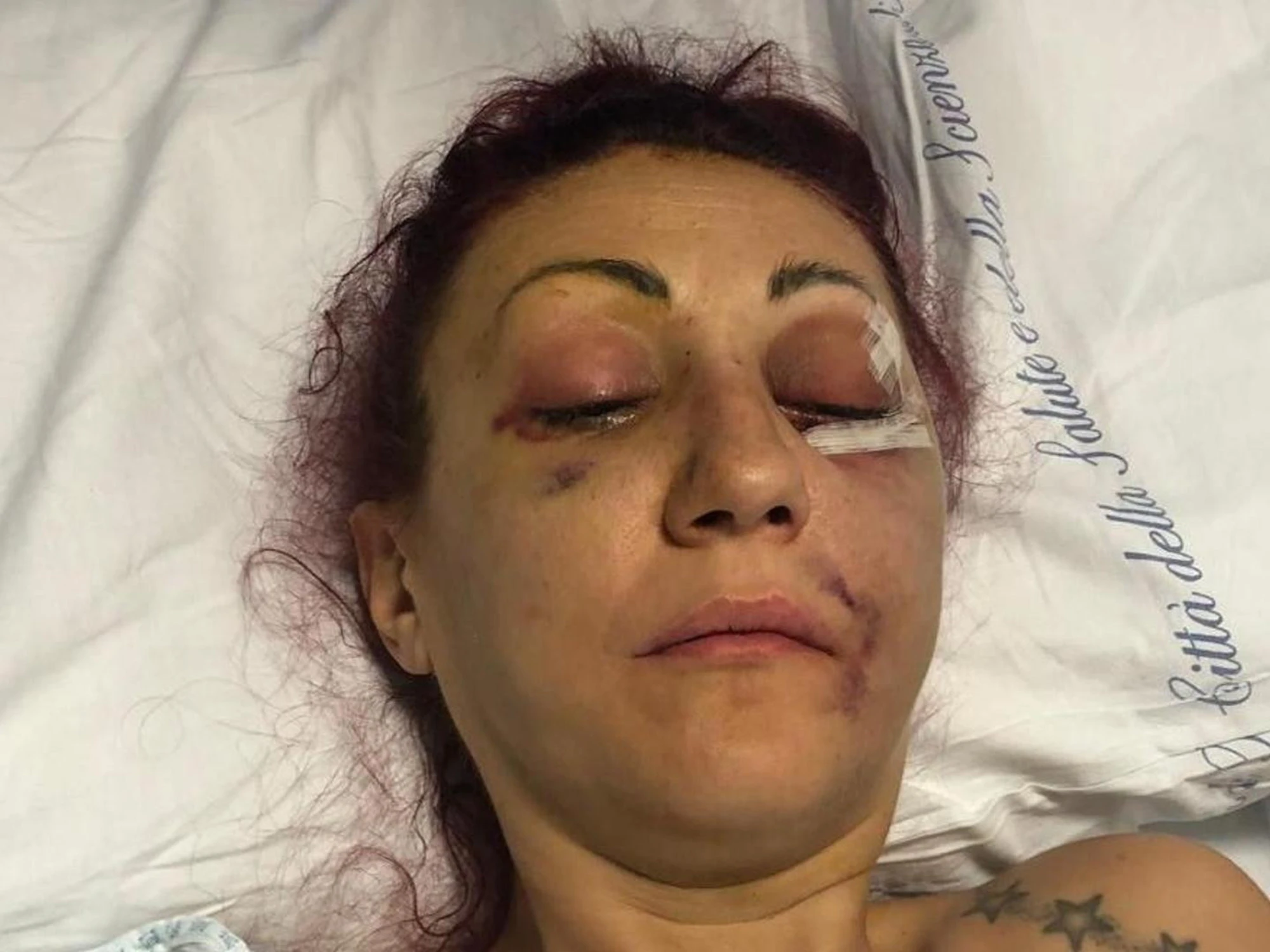 Lucia Regna massacrata dall'ex? Le toghe: "No al carcere. Lei ha sfasciato il matrimonio" 