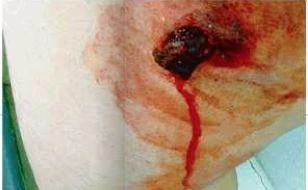 Antifascisti violenti, volevano uccidere il poliziotto a Torino. Lui: "Basta, cosa dobbiamo fare adesso"