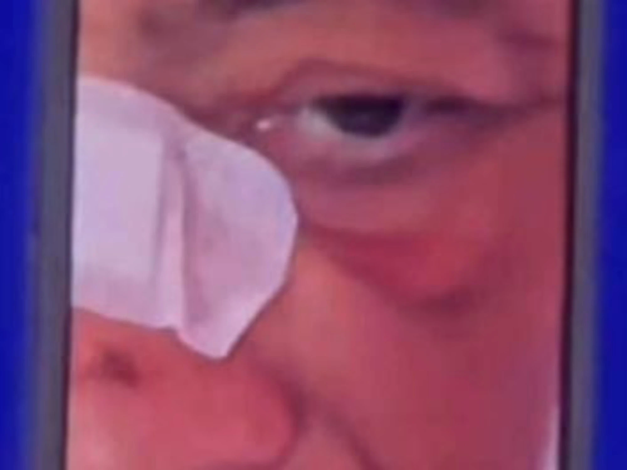 Fiorello, rovinosa caduta in bici: com'è ridotto