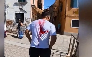 Venezia, spray rosso sui borseggiatori: chi è il "giustiziere della Laguna"