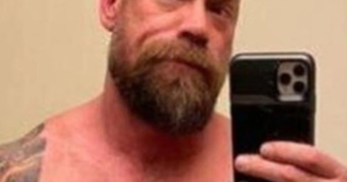 Coronavirus, infermiere Usa perde 23 chili dopo il Covid e si fotografa per fare vedere come è cambiato