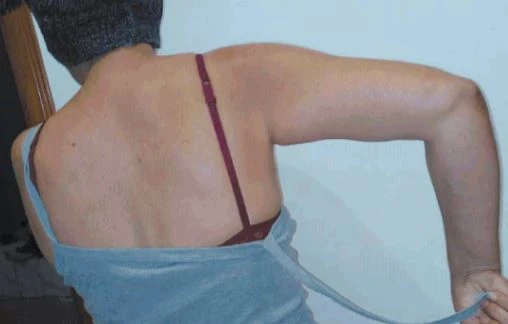 La donna aggredita, dal Tempo