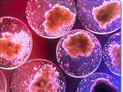 Staminali e terapia genica: funziona la cura che usa virus Hiv