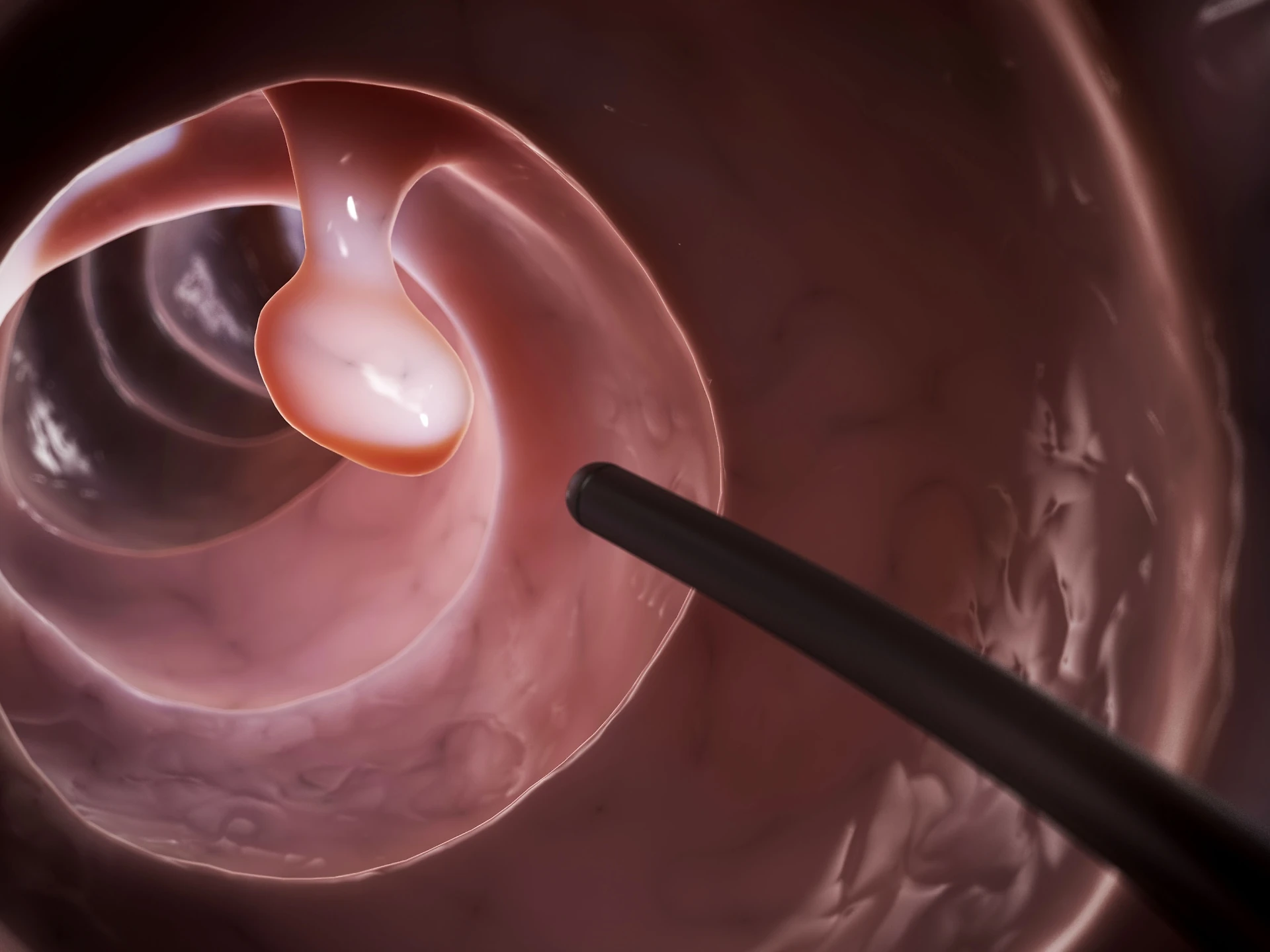 Cancro, la sfortuna non c'entra: la ricerca che dimostra l'incidenza dell'ambiente sui tumori