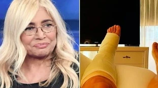 Mara Venier, la frattura non basta: altro guaio, rovinosa caduta nel giardino di casa