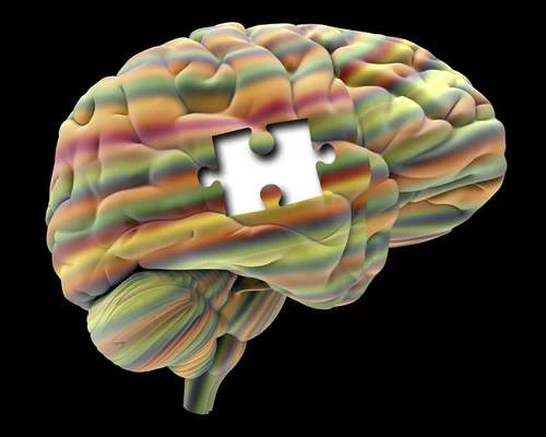 Alzheimer, messo a punto nuovo test per prevedere la malattia 20 anni prima dei sintomi: ecco come