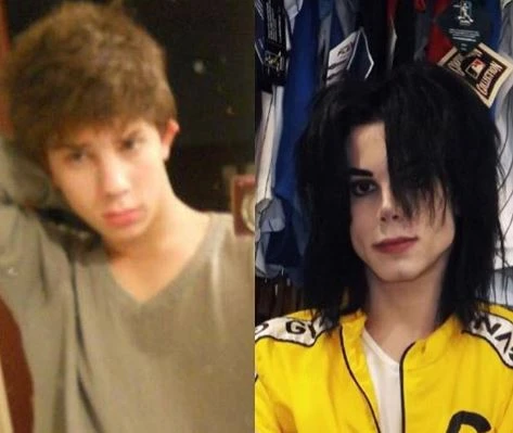 Leo voleva diventare come Michael Jackson: 11 interventi chirurgici, quanto ha speso e com'è adesso