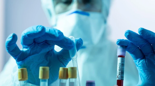 Coronavirus mutato nel Regno Unito e nuovo lockdown, "contagio molto più rapido"
