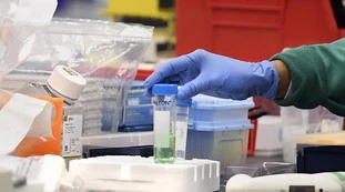 Coronavirus, Melania Rizzoli: ecco perché gli uomini si ammalano più delle donne