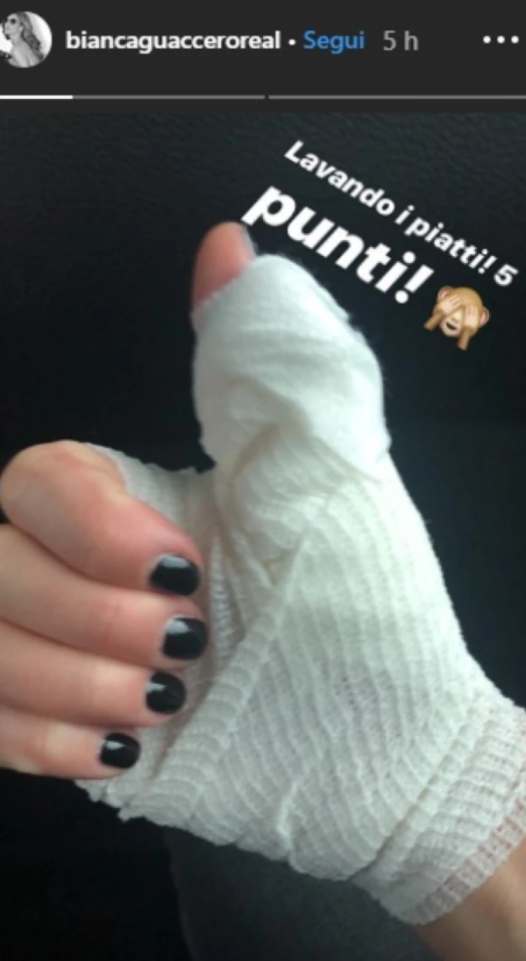 Detto Fatto, diretta maledetta per Bianca Guaccero: cinque punti di sutura, ridotta così