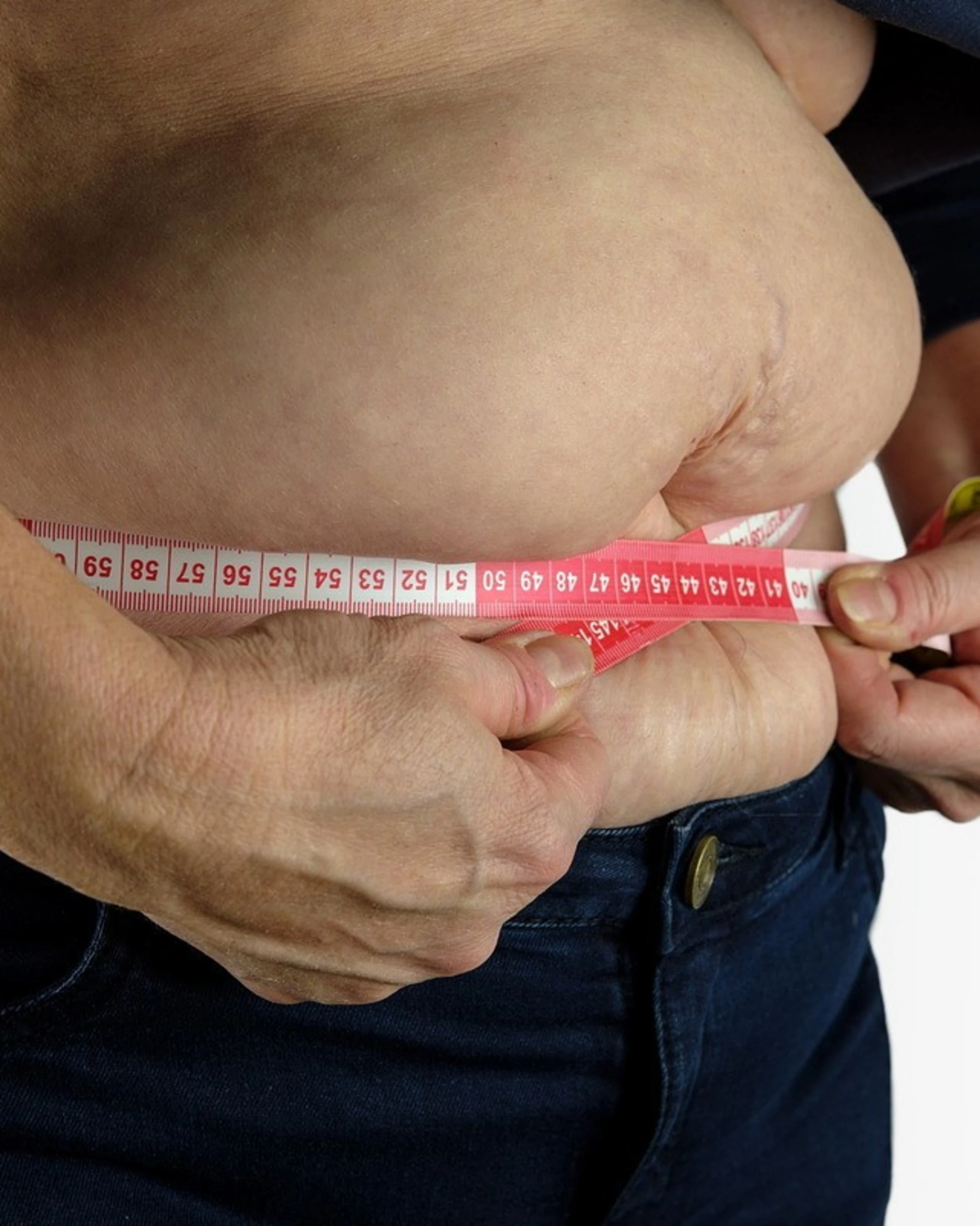 Obesità, il nuovo farmaco: chi può usarlo