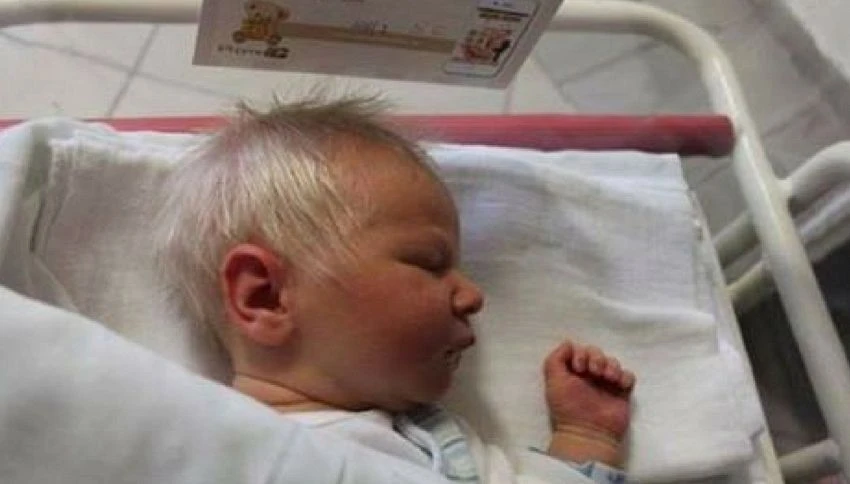 Ungheria, nasce un bambino con i capelli tutti bianchi. Ma non è albino
