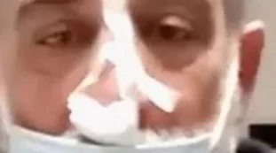 Noventa Padovana, immigrato mostra le parti intime a sua moglie? Lui chiede di smetterla: imprenditore massacrato a mani nude, com'è ridotto