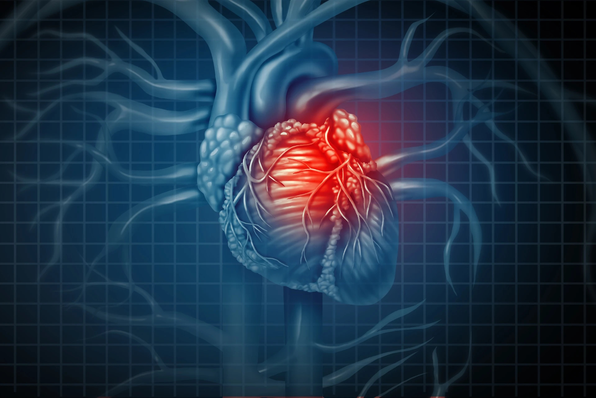 La morte improvvisa si può evitare: ecco tutti i sintomi che preludono all&apos;arresto cardiaco irreversibile