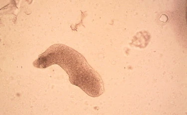 Salmonella nelle mense italiane, "alimento sospeso immediatamente"