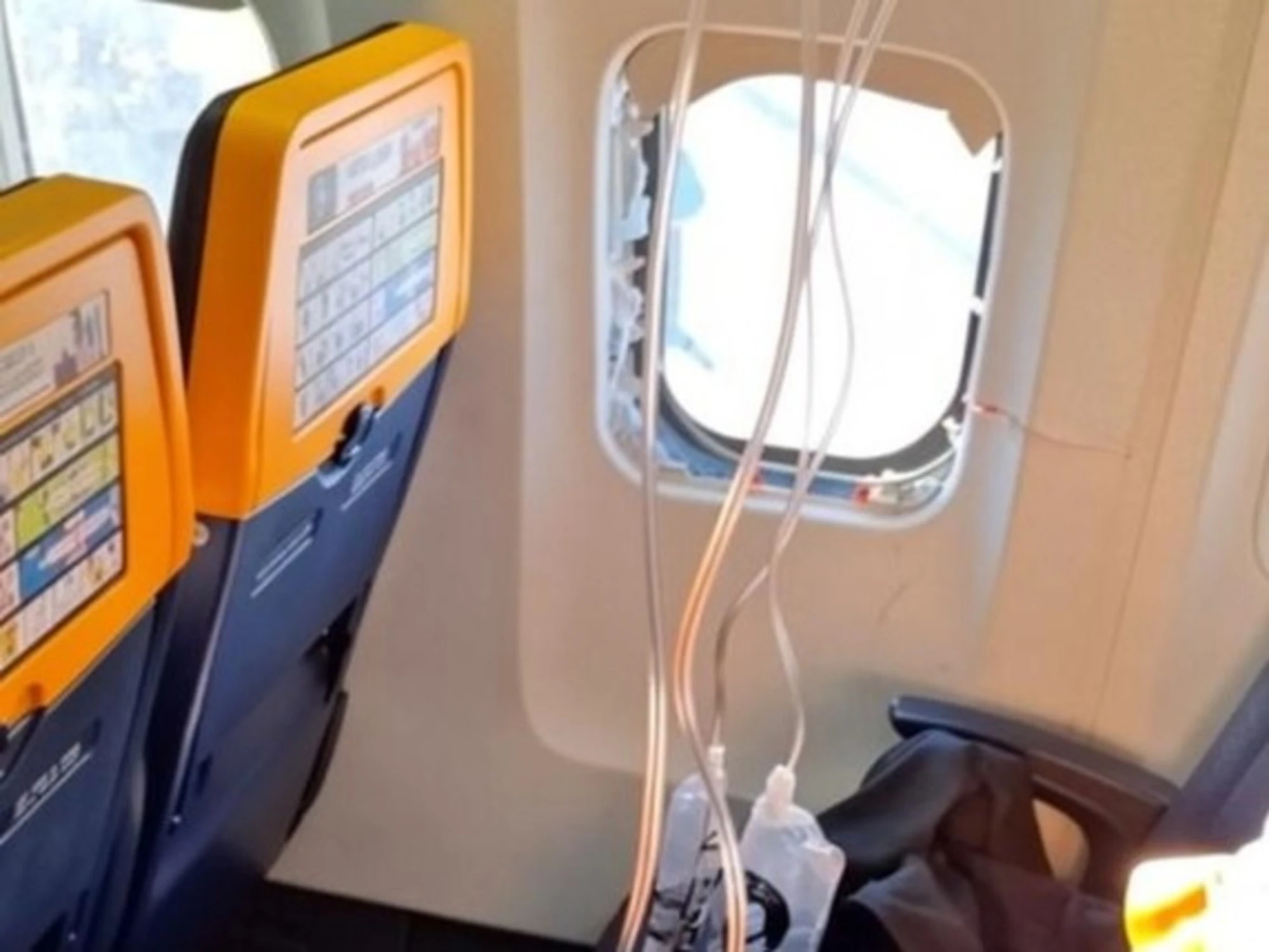 Ryanair, finestrino si rompe in volo: passeggero trattenuto per non essere risucchiato
