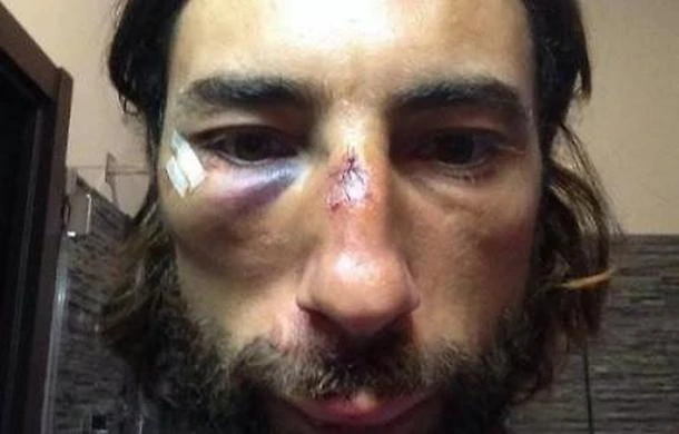 Striscia la Notizia, l'aggressore di Vittorio Brumotti fa una bruttissima fine: clamorosa retata