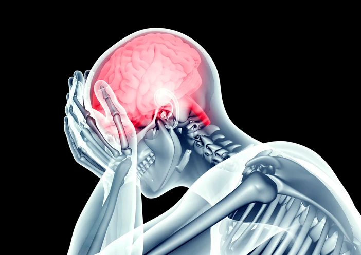 Ictus, un catetere nel cuore blocca gli effetti della fibrillazione atriale