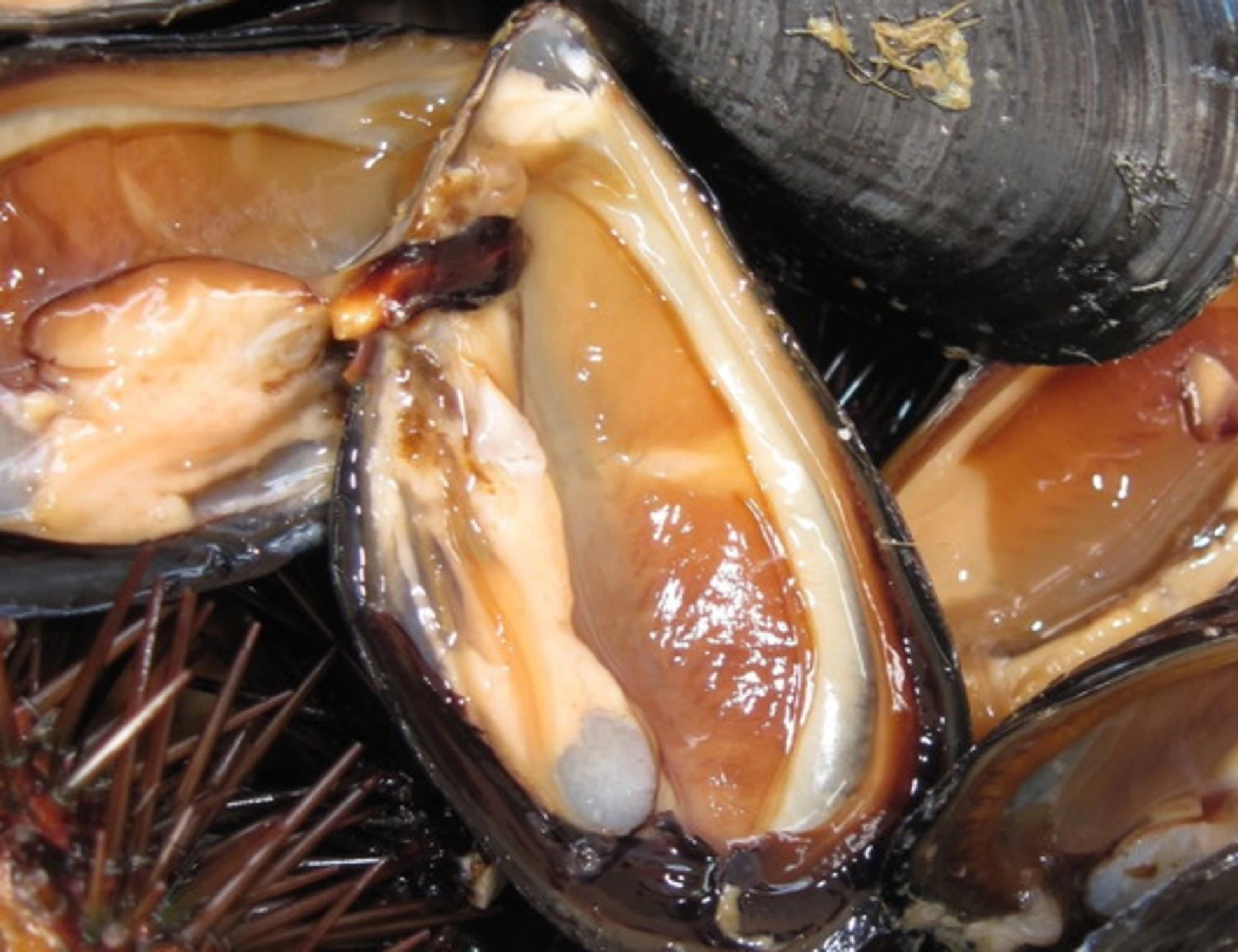 Campania, "epidemia di Epatite A": cause e sintomi, cosa sta succedendo