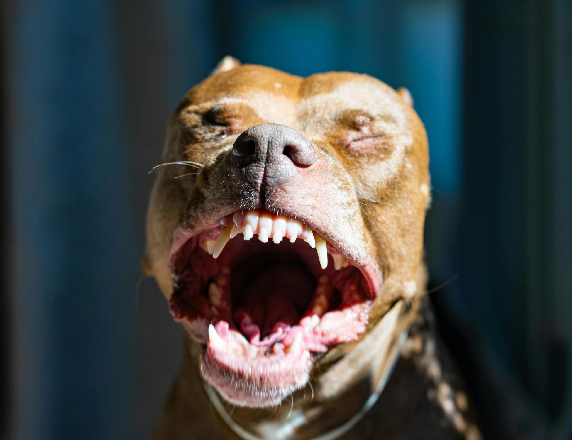 Ischia, donna azzannata da un pitbull: gamba amputata, il cane fa una brutta fine