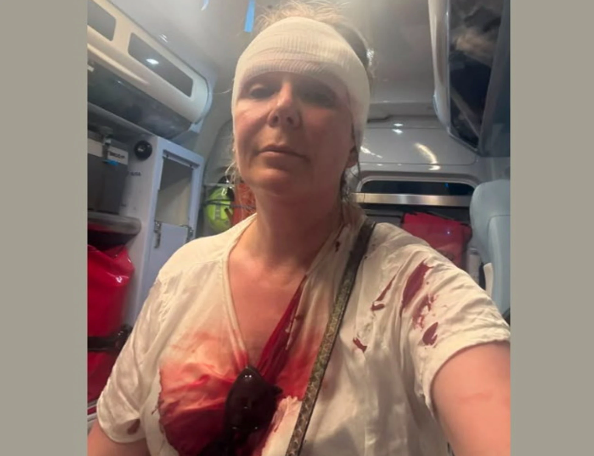 Portomaggiore, massacrata di botte da un marocchino: era a spasso col cane
