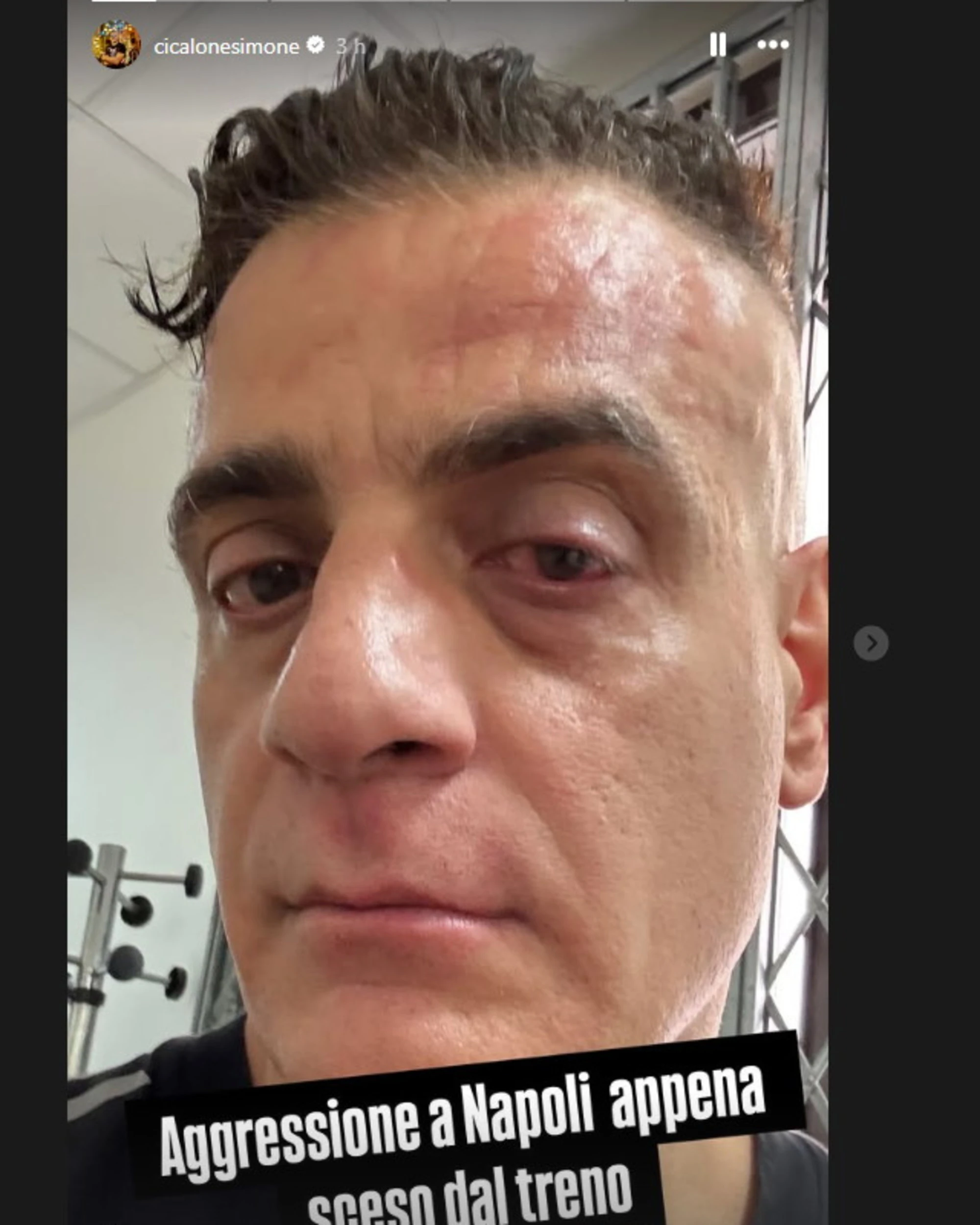 Napoli, Cicalone massacrato dagli africani: finisce malissimo