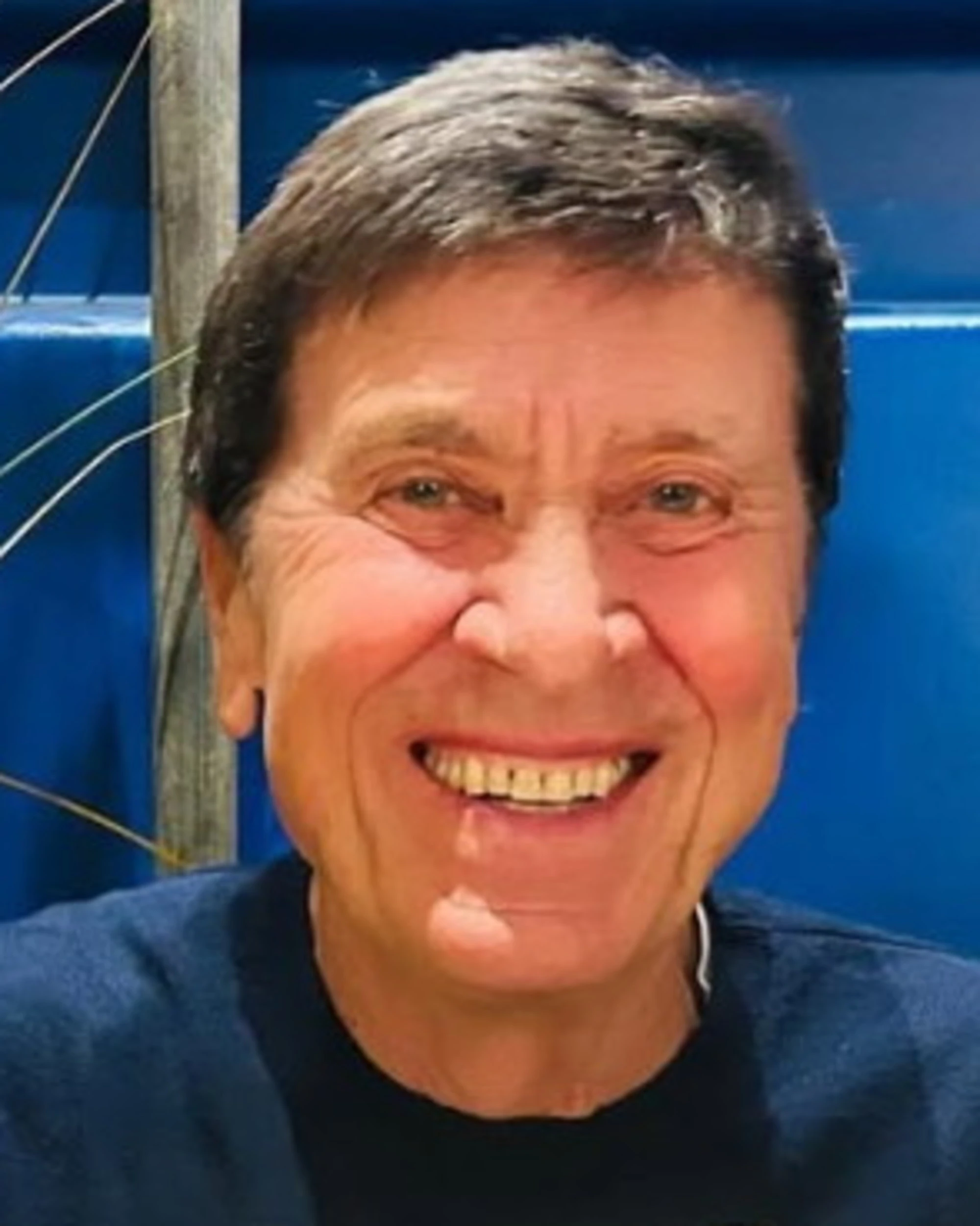 Gianni Morandi, l'occhio sinistro spaventa i fan