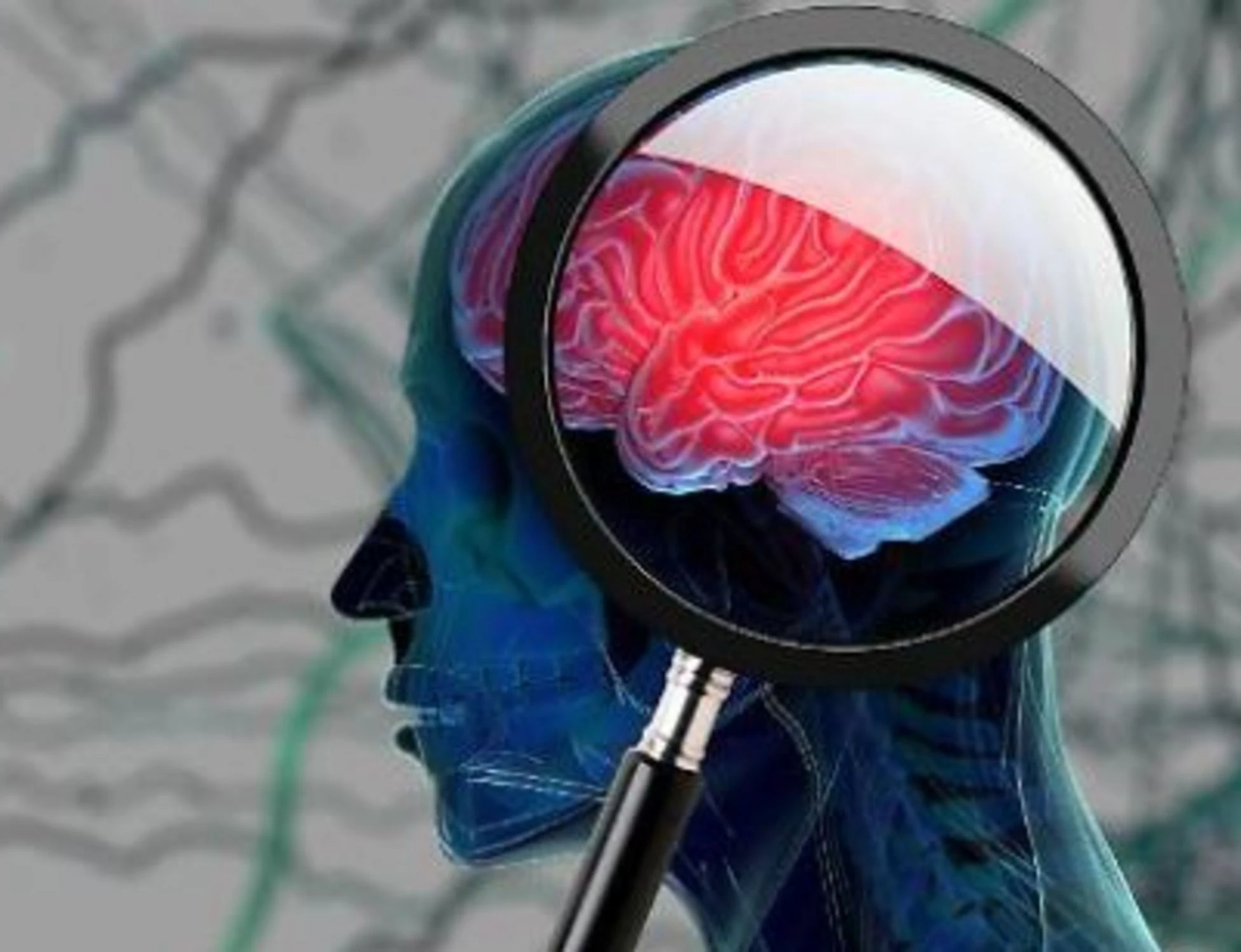 Alzheimer, ecco le regioni in cui si rischia di più