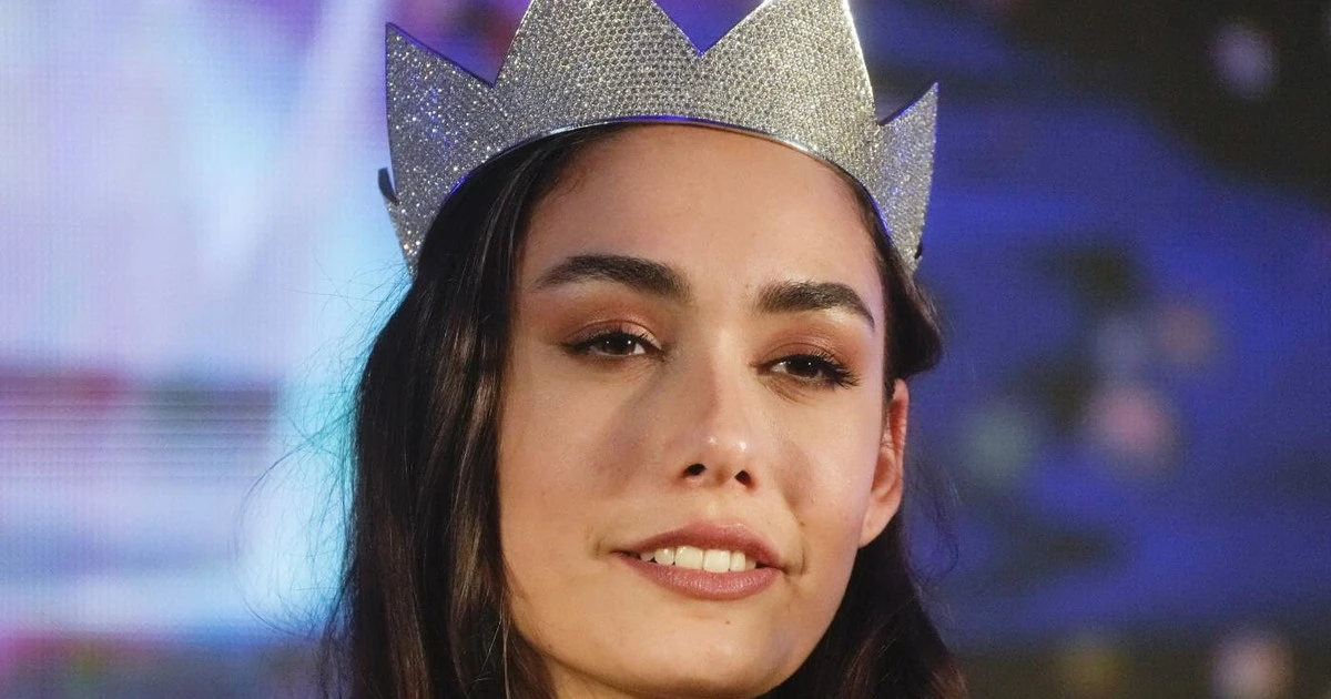 Miss silicone, la differenza tra bellezza ed estetismo da marketing erotico