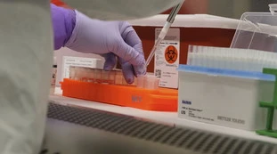 Coronavirus, due "spie" in grado di predire se l'infetto si aggraverà: l'ultima importante ricerca da Wuhan