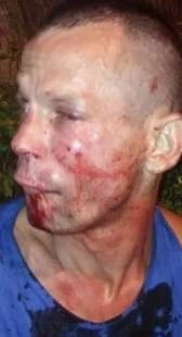 Brasile, prova a rapinare la fighter Polyana Viana: lei gli spacca la faccia e lo fa arrestare