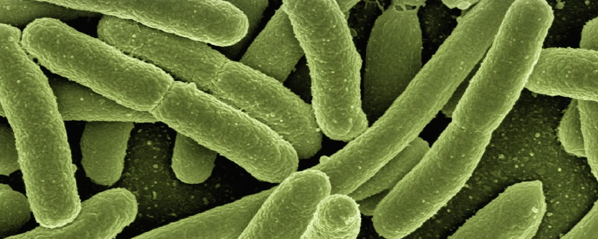 Mal di testa, poi il coma, infine la morte: ameba mangia-cervello, la morte atroce di un ragazzino